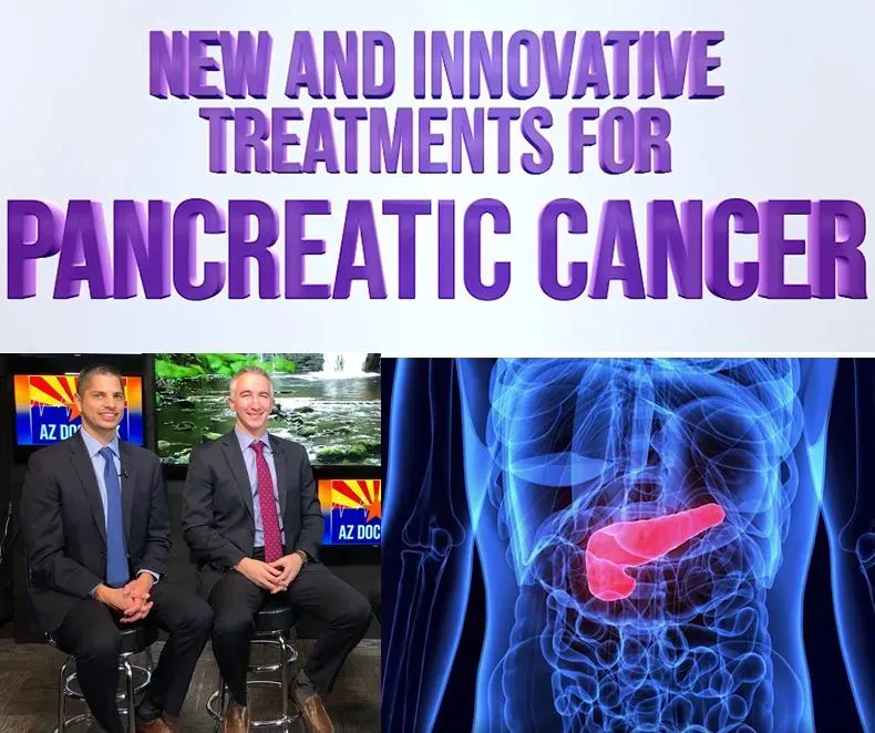 Pancreatic Cancer Clinical Trial